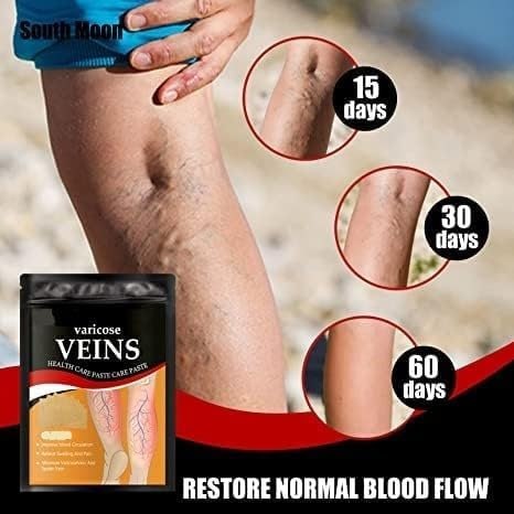 Varicose Veins Patches